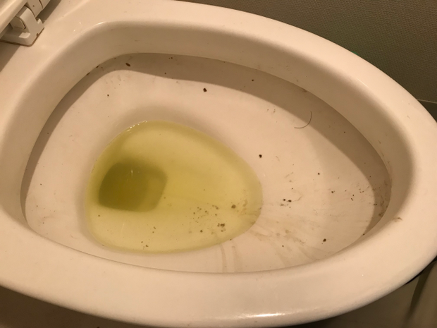便器の中の汚れ