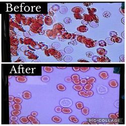 血管観察体験会やってきました✨の画像1