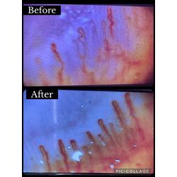 4月3日 血管観察体験会の画像2