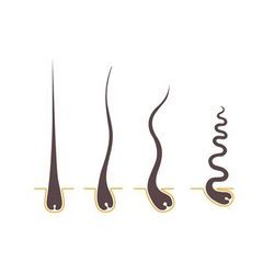 【クセ毛は、なぜうねるのか！？】の画像1